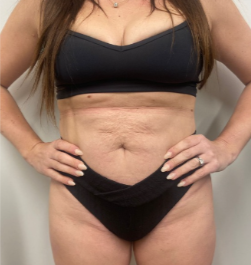 physiq 360 before and after